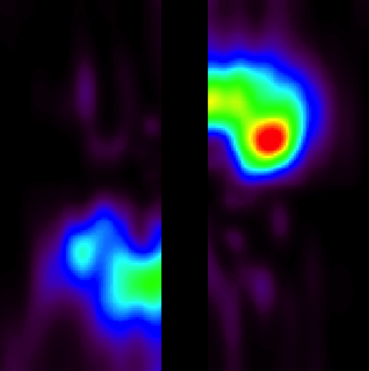 The deprojected ALMA image of carbon monoxide around Beta Pictoris, simulating a view looking down on the system, revealing the large concentration of gas in its outer reaches.  No labels.Credit: Credit: ALMA (ESO/NAOJ/NRAO)/W. Dent et al.